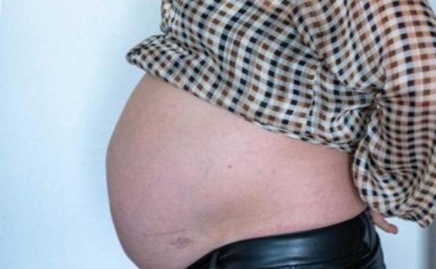 Lleva 10 años «embarazada» por no tratar una distensión del parto