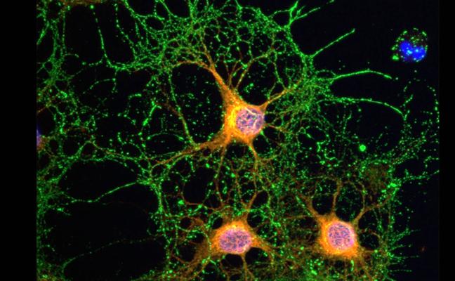 Imagen de una neurona./Universidad de Castilla-La Mancha (UCLM)