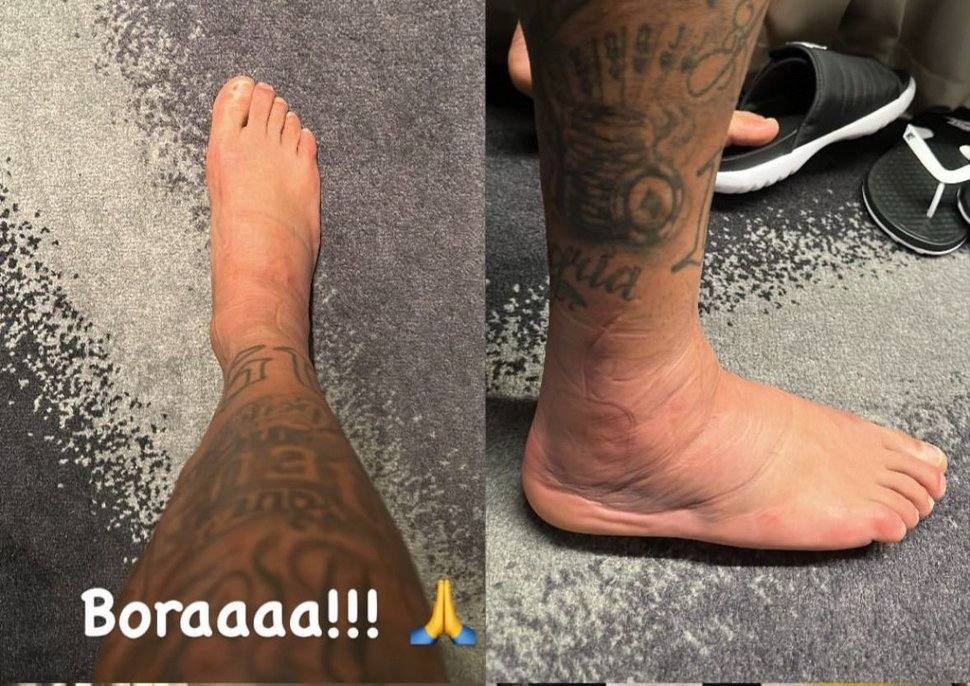 Así está el tobillo de Neymar